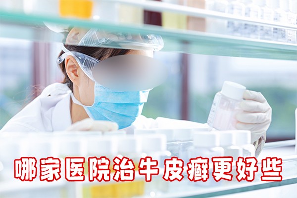 银屑病必做的检查，帮你找到身体问题所在！南京银屑病医院