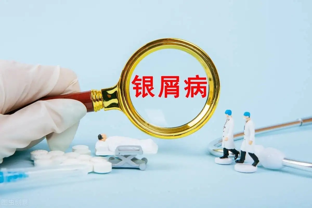 重庆有哪些医院可以治银屑病-牛皮癣患者能做剧烈运动吗